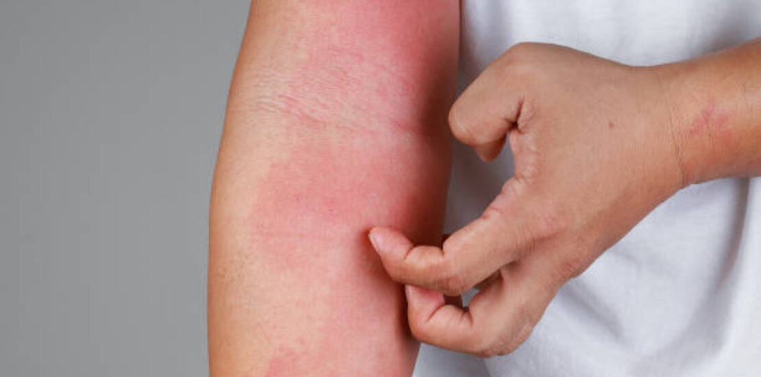 5 Common Skin Conditions That Require a Dermatologist's Expertise