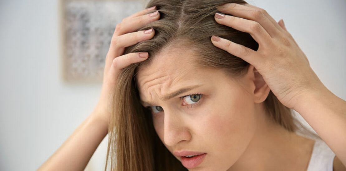 Hair Loss in Women