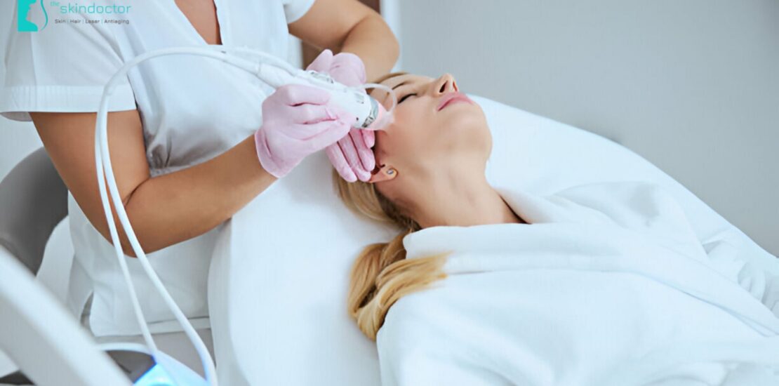 dermapen-microneedling