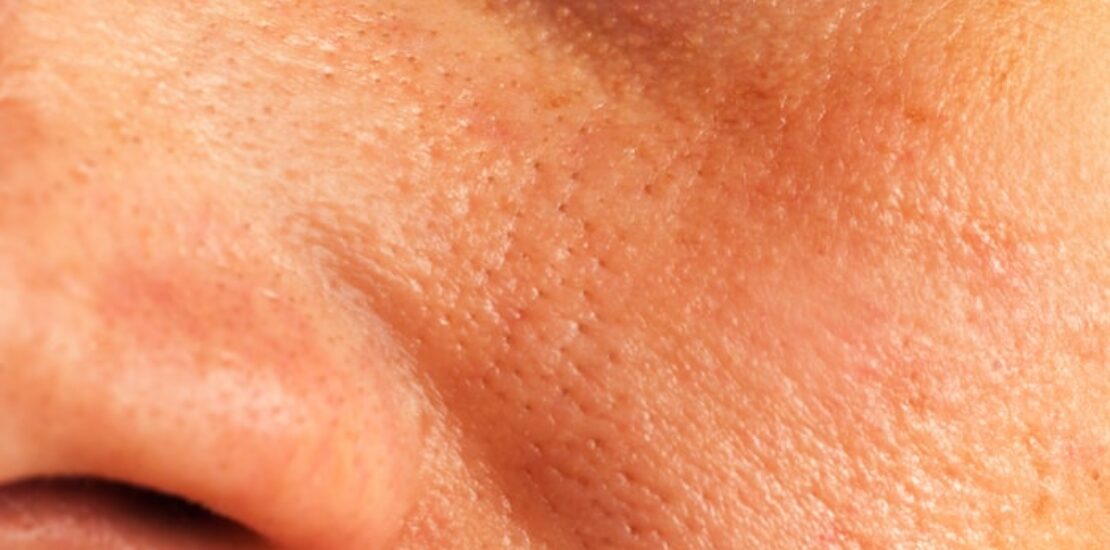 treatment1530516414